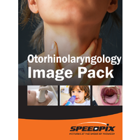 Otorhinolaryngology & Sample Anatomy Image Pack